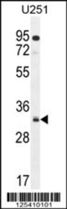 Anti-NUSAP Rabbit Polyclonal Antibody (PE (Phycoerythrin))