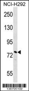 Anti-NOLC1 Rabbit Polyclonal Antibody (HRP (Horseradish Peroxidase))