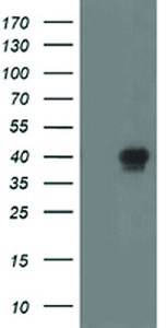 Anti-RLBP1 Mouse Monoclonal Antibody [clone: OTI1F5]