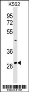 Anti-NRIP2 Rabbit Polyclonal Antibody (APC (Allophycocyanin))