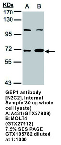 Anti-GBP1 Rabbit Polyclonal Antibody