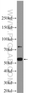 Anti-TEKT3 Rabbit Polyclonal Antibody
