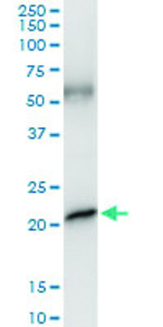 Anti-GH1 Polyclonal Antibody Pair