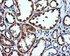 Anti-IFIT1 Mouse Monoclonal Antibody [clone: OTI3G8]