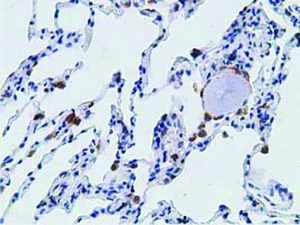 Anti-PECR Mouse Monoclonal Antibody [clone: OTI1C9]