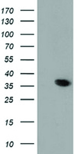 Anti-ANXA3 Mouse Monoclonal Antibody [clone: OTI1F11]