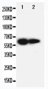 Anti-IL2 Receptor beta Rabbit Polyclonal Antibody