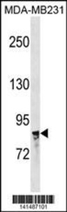 Anti-NR3C1 Rabbit Polyclonal Antibody