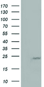 Anti-MOB1B Mouse Monoclonal Antibody [clone: OTI3G9]
