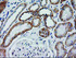 Anti-CTNNB1 Mouse Monoclonal Antibody [clone: OTI1B11]