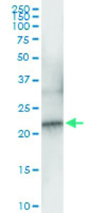 Anti-NDUFB10 Polyclonal Antibody Pair