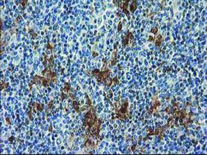 Anti-SULT1C2 Mouse Monoclonal Antibody [clone: OTI5A11]