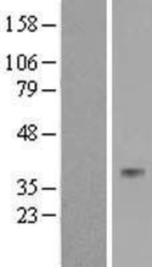 Anti-ASB11 Rabbit Polyclonal Antibody