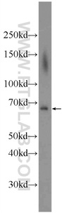 Anti-ADAM8 Rabbit Polyclonal Antibody
