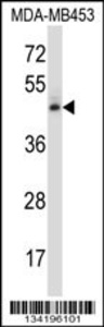 Anti-NR2F1 Rabbit Polyclonal Antibody (FITC (Fluorescein Isothiocyanate))