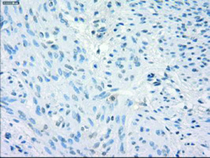 Anti-FCGR2A Mouse Monoclonal Antibody [clone: OTI6H7]