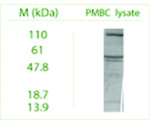 Western blot on Peripheral Blood Mononuclear Cells (PBMC) lysate using Rabbit antibody to ATG9A (APG9L1): whole serum (BSENR-160-100) at a dilution of 1: 100 (ECL).