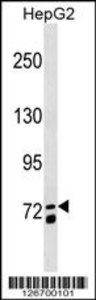 Anti-MS4A14 Rabbit Polyclonal Antibody (FITC (Fluorescein Isothiocyanate))