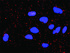 Anti-CCNE1 + GSK3B Antibody Pair