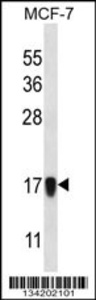 Anti-NDUFA13 Rabbit Polyclonal Antibody (Biotin)