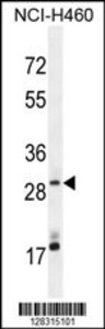 Anti-MAGIX Rabbit Polyclonal Antibody (PE (Phycoerythrin))