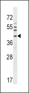Anti-NKX6-1 Rabbit Polyclonal Antibody