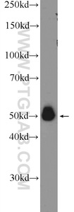 Anti-A4GALT Rabbit Polyclonal Antibody