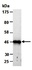 Western blot analysis of total cell extracts from human A431 using KRT18 antibody