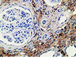 Anti-ADH1B Mouse Monoclonal Antibody [clone: OTI5D7]
