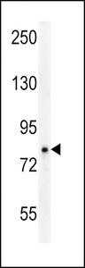 Anti-OCA2 Rabbit Polyclonal Antibody (FITC (Fluorescein Isothiocyanate))