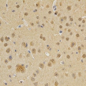 IHC-P staining of mouse brain tissue using DNMT3A antibody (primary antibody dilution at 1:200)