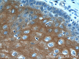 Anti-LCE1A Rabbit Polyclonal Antibody