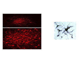 Left: Visualisation of dopaminergic neurons in formalin-fixed floated cryostat section from the rat zona incerta by IHC. Photo courtesy of Dr. Erik Hrabovszky, Hungarian Academy of Sciences, Budapest, Hungary. Right: Staining of TH-IR catacholaminergic neurons in the rat brainstem using DAB method.