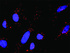 Anti-GSK3B + AXIN1 Antibody Pair