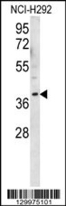 Anti-OR2AK2 Rabbit Polyclonal Antibody (PE (Phycoerythrin))