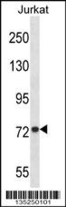 Anti-MFN1 Rabbit Polyclonal Antibody (AP (Alkaline Phosphatase))