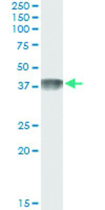 Anti-C4BPB Antibody Pair