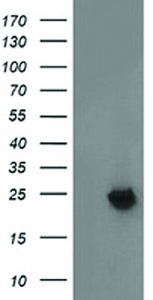 Anti-MMAB Mouse Monoclonal Antibody [clone: OTI1G3]