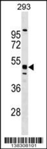 Anti-MTL5 Rabbit Polyclonal Antibody (AP (Alkaline Phosphatase))