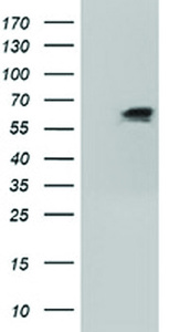 Anti-IGF2BP2 Mouse Monoclonal Antibody [clone: OTI4C4]