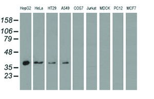 Anti-HIBCH Mouse Monoclonal Antibody [clone: OTI3G1]