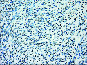 Anti-KDM4C Mouse Monoclonal Antibody [clone: OTI4B1]