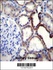 Anti-NKD2 Rabbit Polyclonal Antibody (AP (Alkaline Phosphatase))