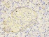 IHC-P staining of mouse lung tissue using IL1RN antibody (primary antibody dilution at 1:200)