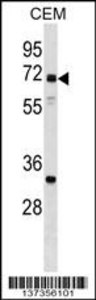 Anti-NPLOC4 Rabbit Polyclonal Antibody (HRP (Horseradish Peroxidase))