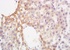 Anti-GCKR Rabbit polyclonal antibody
