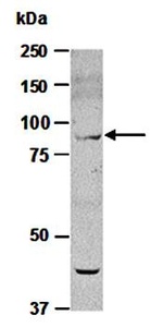 Western blot analysis of total cell extracts from human 293T Hela using SUZ12 antibody