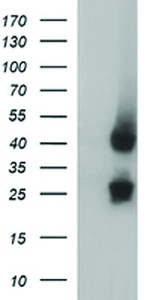Anti-MFAP3 Mouse Monoclonal Antibody [clone: OTI1G1]