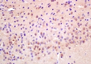 Immunohistochemical analysis of formalin-fixed paraffin embedded rat brain tissue using RAD21 antibody (dilution at 1:200)