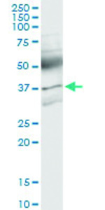 Anti-ACVR2B Polyclonal Antibody Pair